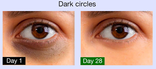 slide3